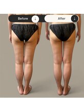 ベオ(Salon Beo)/下半身モニター様