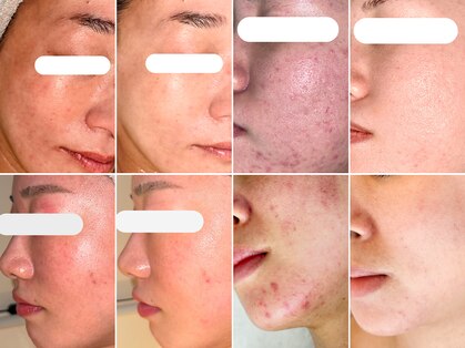 韓国肌管理室 ソア(soa)の写真