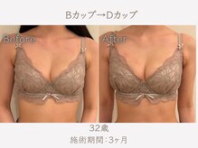 ハリスタ 天王寺院(HARISTA)/3ヶ月間でBカップ→Dカップ