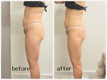 Beauty salon CENDRILLON【サンドリヨン】/ペルソナ痩身体験