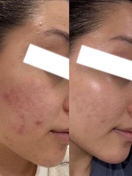ソウ(SOW)の写真/【30代からの本気のエイジングケア】ハリ・弾力・引き締まった若々しい印象へ♪年齢に負けないお肌へ☆