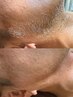 【男性限定!50%OFF】清潔感が変わる本気ケア!