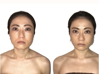 小顔整体研究所 KSラボ 藤が丘店/