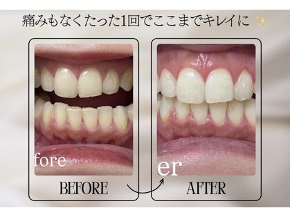 ティーベル(TeeBEL)の写真