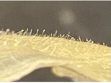 ベイス(BASE)/産毛、皮脂は目に見えます