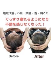 アサバ整体院 江戸川台店(ASABA整体院)/頭蓋骨調整の結果写真