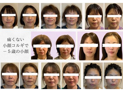 ビーサロン(B-salon)の写真