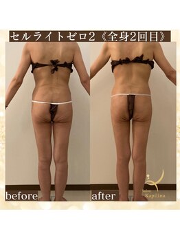 サロン カピリナ(salon Kapilina)/【before→after】