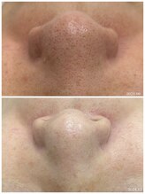 ヒルナム(Heal Nam)/~プロセルセラピーズ~フェイス