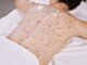 ナプスシェービング(Naps Shaving)の写真/《国家資格保有》夏に向けてムダ毛を徹底ケア!赤みが出にくいシェービング&本格保湿パックでつるすべ肌に♪