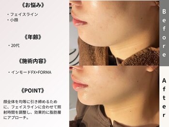 ルディラ 大宮店/インモードFX+FORMA