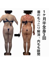 スピード美人 新宿店/スライドカッピング全身3回