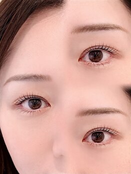 アルーマ アイ(allma.eye)/上下まつけパーマ