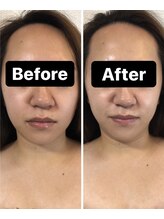 小顔コルギサロン シー(She)/【コルギ】1度の変化!