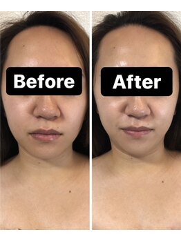 小顔コルギサロン シー(She)/【コルギ】1度の変化!