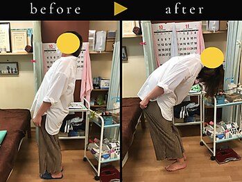 杉本接骨鍼灸院/若々しい背骨を取り戻す整体