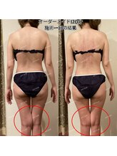 アユスリム(AYU SLIM)/一回でも変化できるの充実痩身