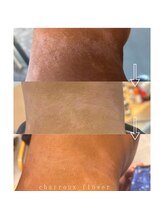 コルザフラワー(charroux flower)/ご相談ください！