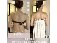 蒼(so)の雰囲気（一般的な整体や機器では解決できない側湾の方へ。『駆け込み寺』）