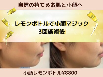 フェリス(feliz)の写真