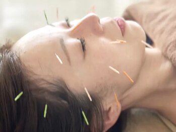 美肌脱毛 ビハダモ(Bihadamo)の写真/美容鍼、トライしてみない?表情筋を整え、たるみをケア。自律神経のバランスにも配慮し、内側からスッキリ