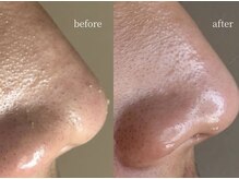 サロン モウ(mou。)の雰囲気(頑固な毛穴の黒ずみは、毛穴講師がごっそり綺麗に!)