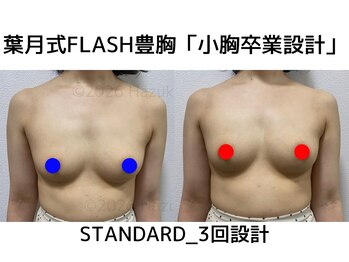 セブンシーズ 上野店(Seven Seas)/バストアップ/豊胸/東京都/上野