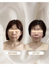 トロワ(TROIS)/きれいになるための必勝法