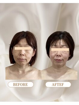 トロワ(TROIS)/きれいになるための必勝法