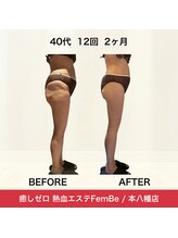 フェムビー(FEMBE)/結果重視の【２ヶ月集中コース】