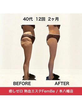 フェムビー(FEMBE)/結果重視の【２ヶ月集中コース】