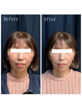 たくろう鍼灸院 豊田本院/Before&After