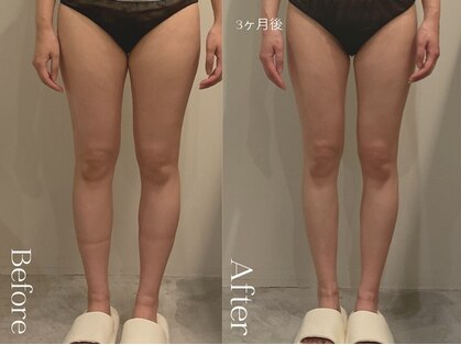 ユーフォリア グロウ(euphoria glow)の写真