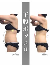 ステイゴールド美容整体院(STAY GOLD)/下っ腹気になってませんか？