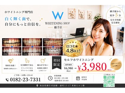 ホワイトニングショップ 秋田横手店の写真