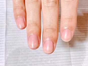 エクレネイルズ(eclait nails)の写真/角質ケアでお爪周り・かかとまでつるすべをGet◇自信を持てる美しい足元・指先に♪【角質ケア¥5500～】
