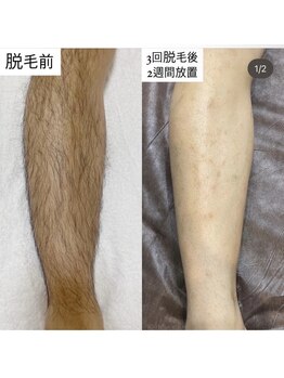 ルトゥール(Retour)/メンズ ひざ下