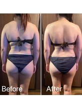 リコ 白金台(Liko)/ビフォーアフター【背中1回】