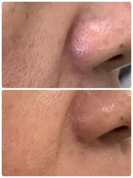 プリマプリート 大垣店/グレーズソフトピール