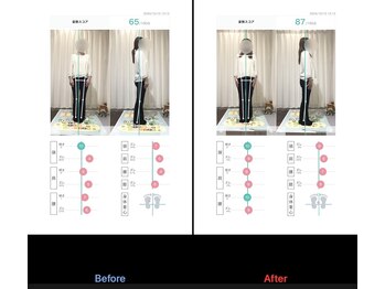 鹿児島整体院/☆AI姿勢分析を導入　猫背改善