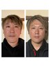 【たるみケア、ほうれい線、老け顔に◎】韓国式小顔再生フェイシャル　90分