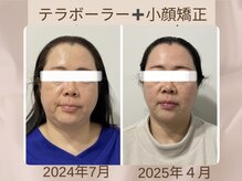 骨格美容サロン/小顔矯正