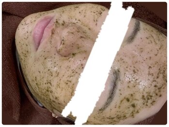 カピリナ(ka pilina)/★ハーブピーリングで根本改善★