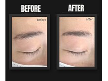 ネムリビト/眉癖矯正