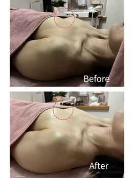 チュラ 大宮店(Chura)/肩位置激変→谷間も激変(4/4)