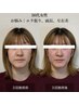 4/30まで3名限定【エラ・面長・歪み】オーダーメイド小顔矯正 ¥16500→¥5500