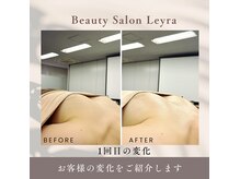 レイラ(Leyra)の雰囲気（育乳プロが育ちづらい原因を徹底解明◎バストアップは夢じゃない）