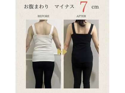 オパージュ(Opage)の写真