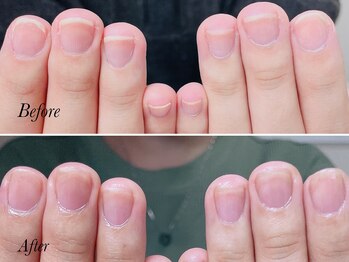 トゥインクリーネイルサロン(Twinkly Nail Salon)/【最強のネイルケア】1回お試し