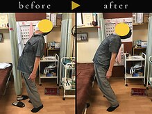 杉本接骨鍼灸院/若々しい背骨を取り戻す整体